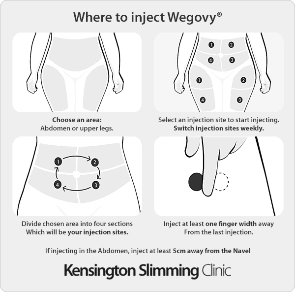 A diagram illustrating the safe and recommended injection sites for Wegovy: the abdomen, upper thigh, and upper arm